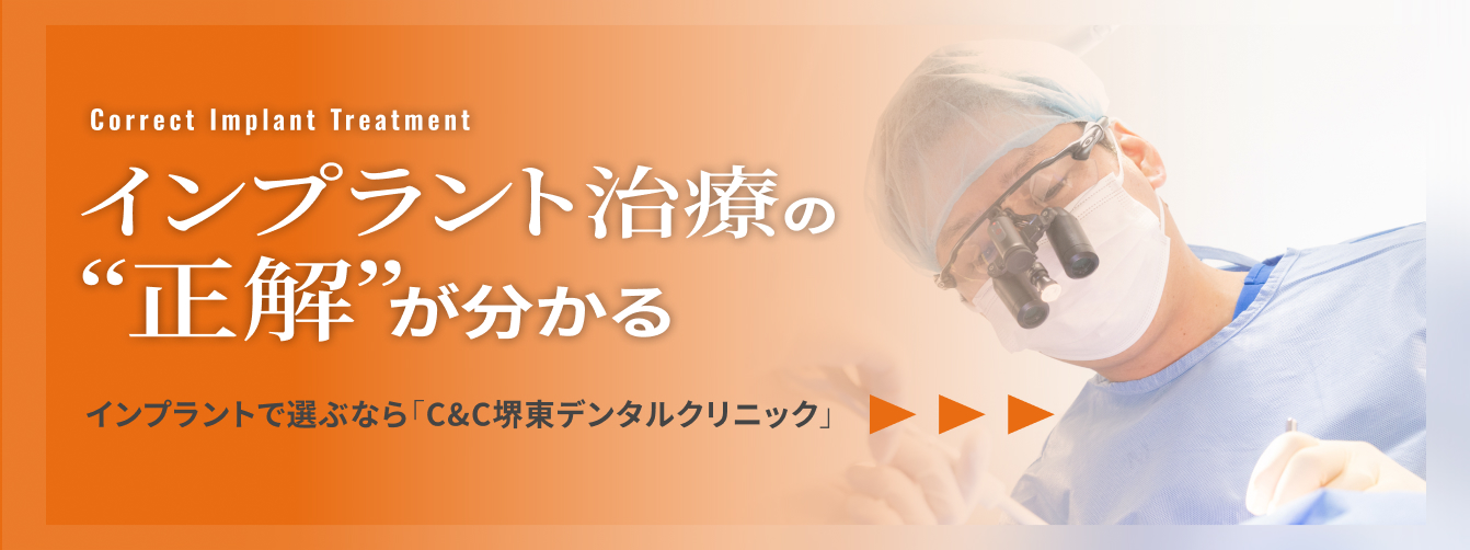 インプラント