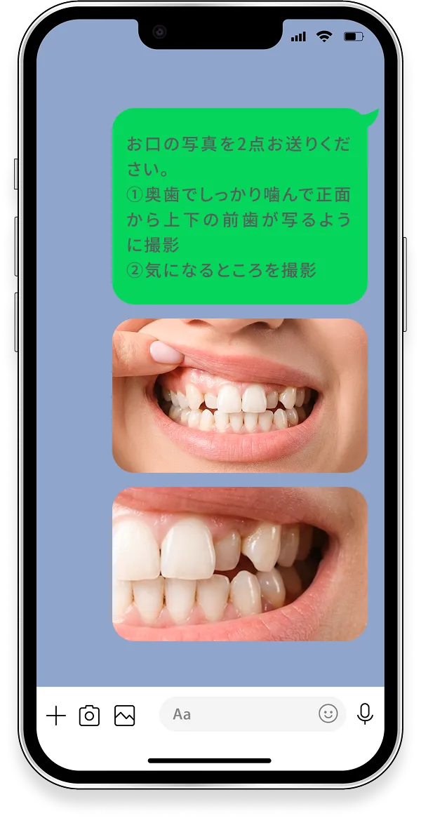 STEP② お悩み内容と歯並びの写真を送る例：マウスピース矯正で対応できますか？／治療期間はどのくらいになりますか？