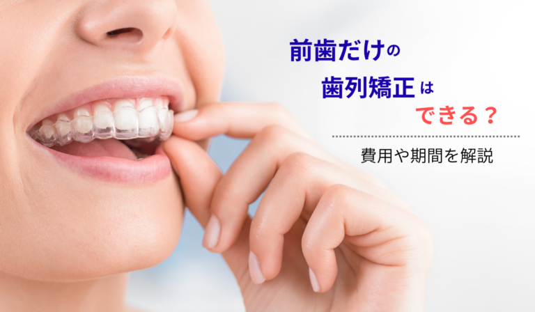 前歯だけの歯列矯正はできる？できる・できないケースと費用や期間を解説